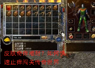 皮肤奇痒难耐?如何快速止痒闯关传奇世界 皮肤奇痒难耐?如何快速止痒闯关传奇世界