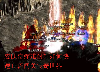 皮肤奇痒难耐?如何快速止痒闯关传奇世界 皮肤奇痒难耐?如何快速止痒闯关传奇世界