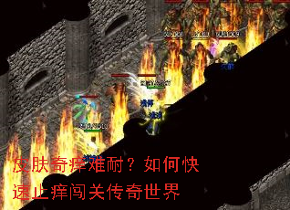 皮肤奇痒难耐?如何快速止痒闯关传奇世界 皮肤奇痒难耐?如何快速止痒闯关传奇世界