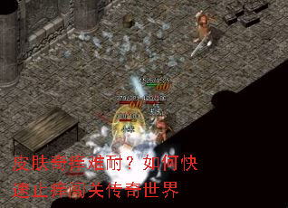 皮肤奇痒难耐?如何快速止痒闯关传奇世界 皮肤奇痒难耐?如何快速止痒闯关传奇世界